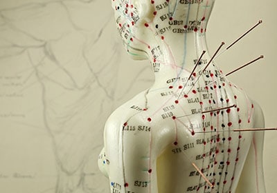 ourchiro treatment acupuncture techniques in brisbane chiropractor and musculoskeletal