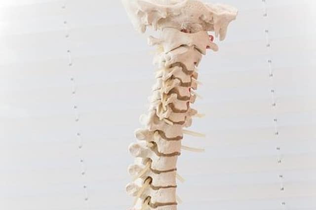 sciatica photo