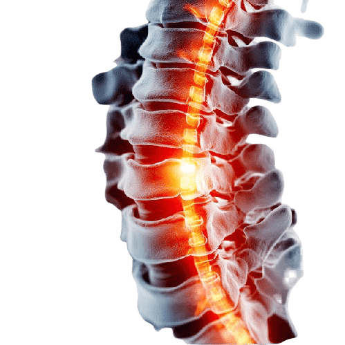spinal column pain anatomy illustration medical image 84443 40499.jpg removebg preview - Homepage