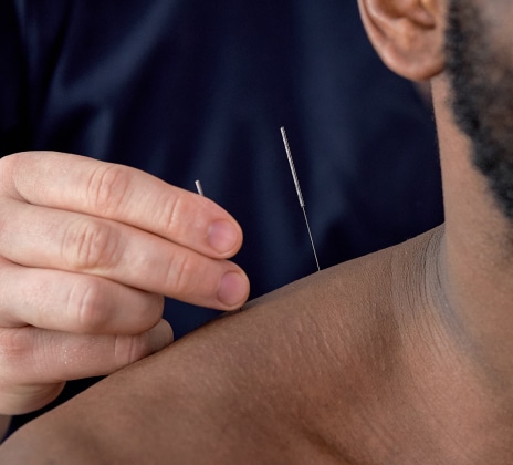 Acupuncture Bottom 1 - Acupuncture