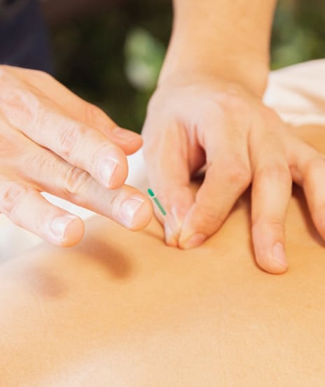 Bottom 2 10 - Dry Needling Therapy