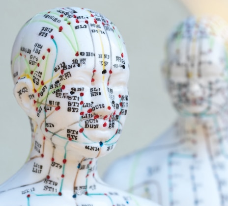 Bottom 3 9 - Dry Needling Therapy