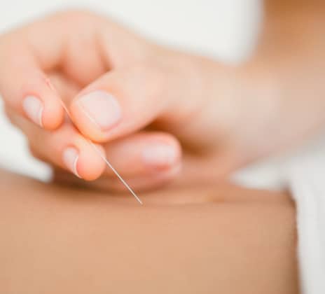 Acupuncture Bottom 3 - Acupuncture