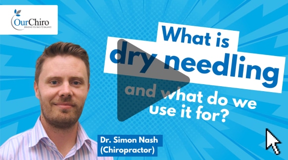 What is dry needlig - Dry Needling Therapy