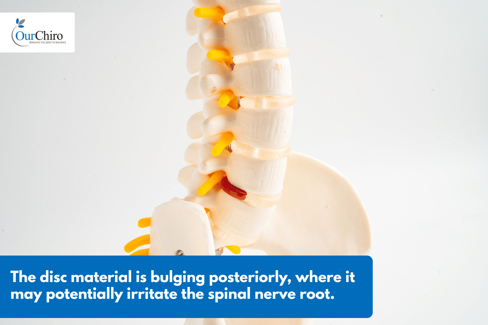 What is a slipped disc and how can chiropractic help  Annotated - What is a slipped disc, and how can chiropractic help?