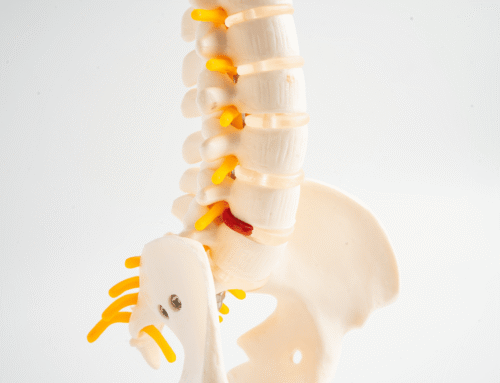 What is a slipped disc and how can chiropractic help  Cover 500x383 - What can cause leg pain, and how can chiropractic help?