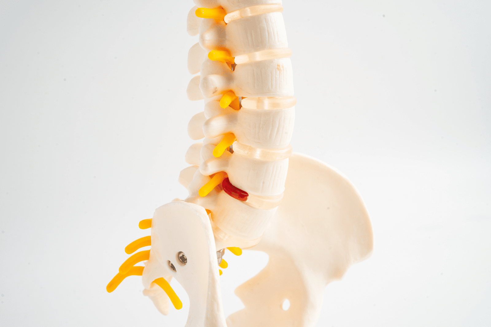 Homepage What is a slipped disc and how can chiropractic help Cover - Homepage