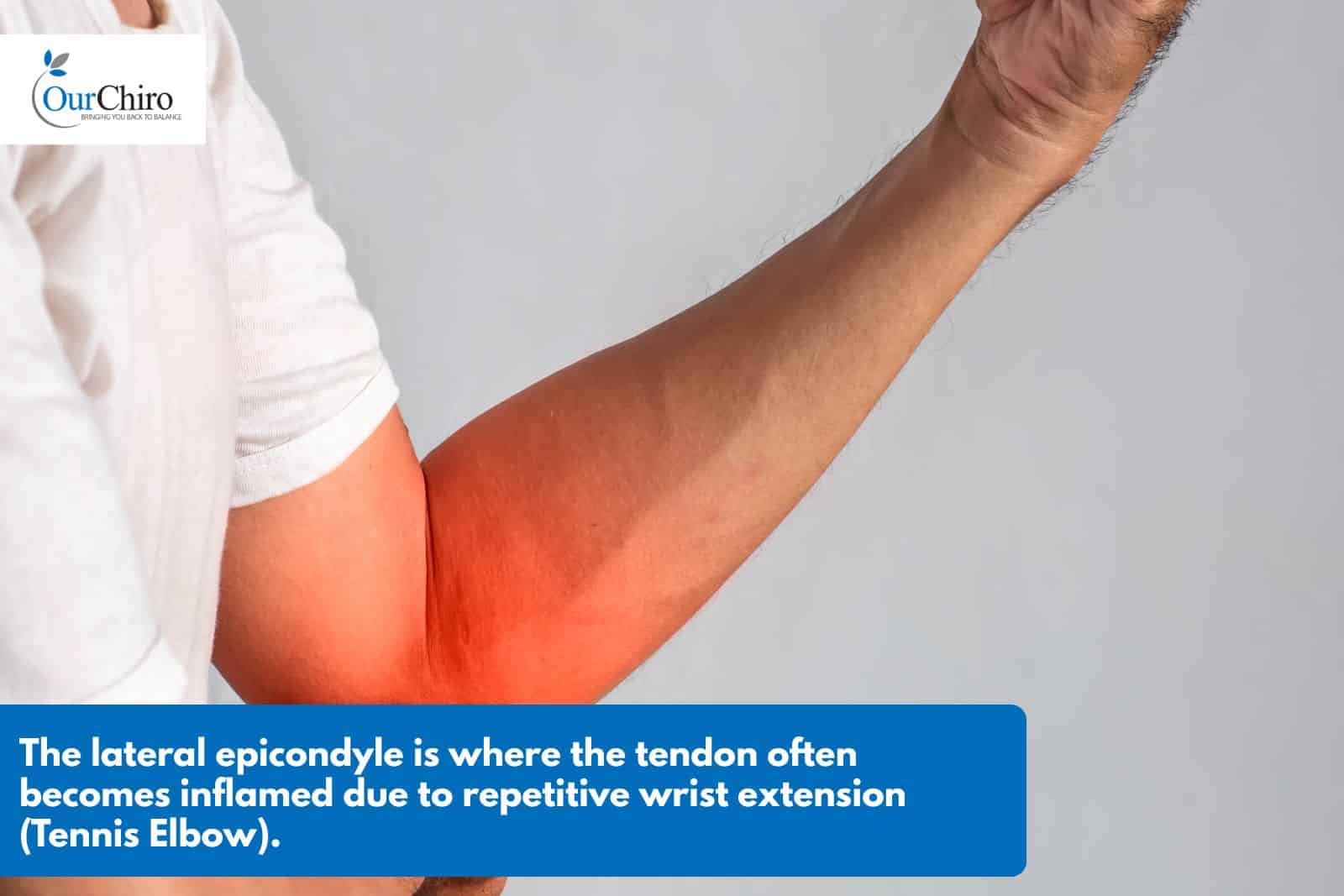 What is tendonitis? Whats the difference between tendonitis and tendinopathy annotated - What is tendonitis?
