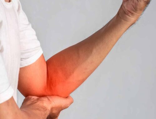 Whats the difference between tendonitis and tendinopathy feature 500x383 - What is cupping therapy?