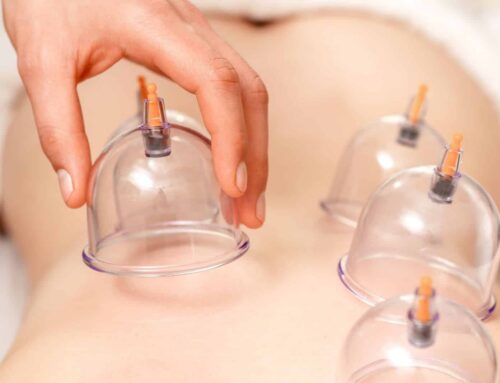 cupping therapy. feature 500x383 - What common shoulder problems can a chiropractor help with?