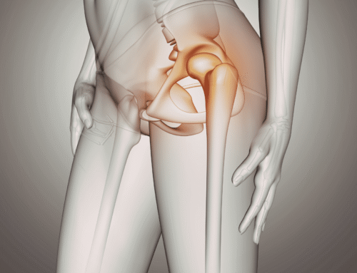 Hip Pain Cover 500x383 - What can cause leg pain, and how can chiropractic help?