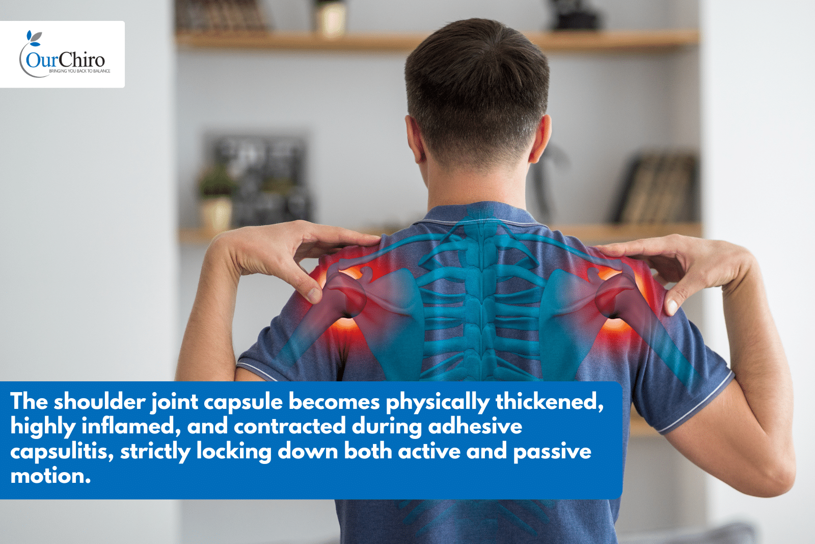 Frozen Shoulder Annotated - What is frozen shoulder and what can you do about it?