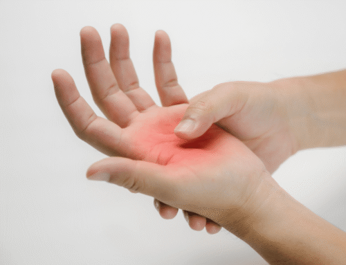 hand tingling annotated 500x383 - What is remedial massage?